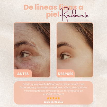 SKINLIFT™ | TU PIEL MÁS FIRME Y RADIANTE AL INSTANTE
