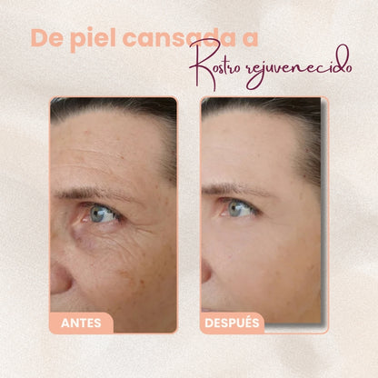 SKINLIFT™ | TU PIEL MÁS FIRME Y RADIANTE AL INSTANTE